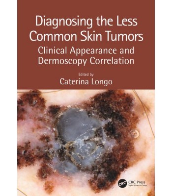 Diagnosing the Less Common Skin Tumors: Clinical Appearance and Dermoscopy Correlation