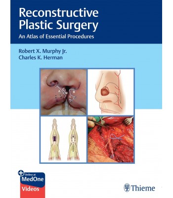 Reconstructive Plastic Surgery: An Atlas of Essential Procedures