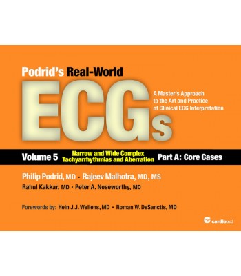 Podrid’s Real-World ECGs, Volume 5: Narrow and Wide Complex Tachyarrhythmias and Aberration