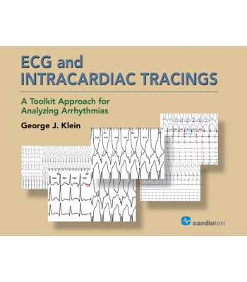 ECG and Intracardiac Tracings: A Toolkit Approach for Analyzing Arrhythmias