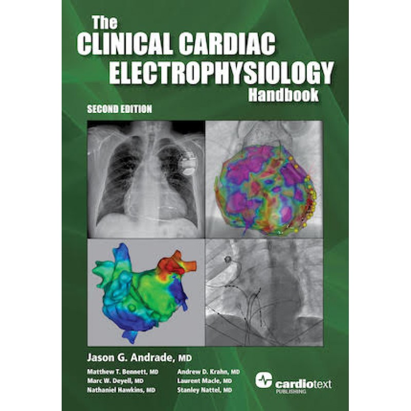 The Clinical Cardiac Electrophysiology Handbook, Second Edition
