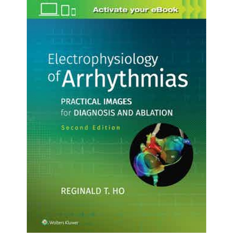 Electrophysiology of Arrhythmias Practical Images for Diagnosis and Ablation, 2nd edition