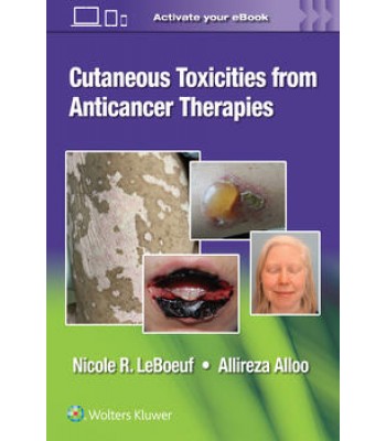 Cutaneous Reactions from Anti-Cancer Therapies