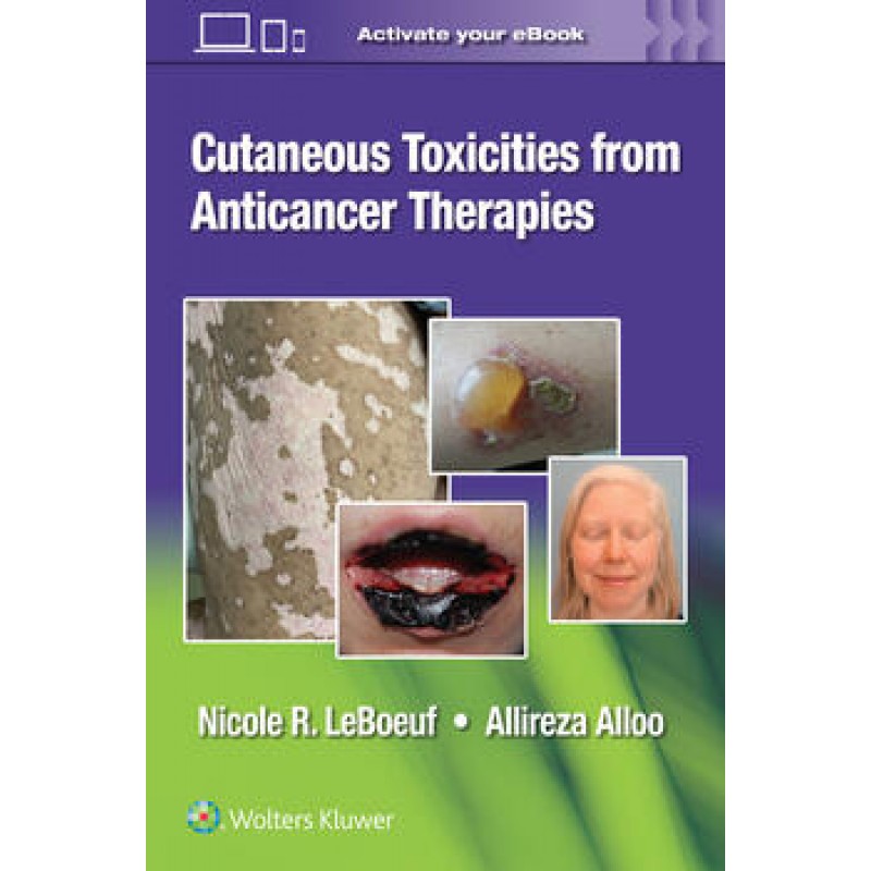 Cutaneous Reactions from Anti-Cancer Therapies