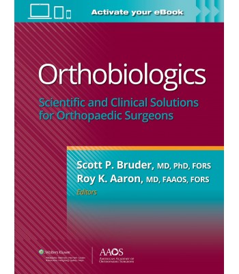 Orthobiologics: Scientific and Clinical Solutions for Orthopaedic Surgeons
