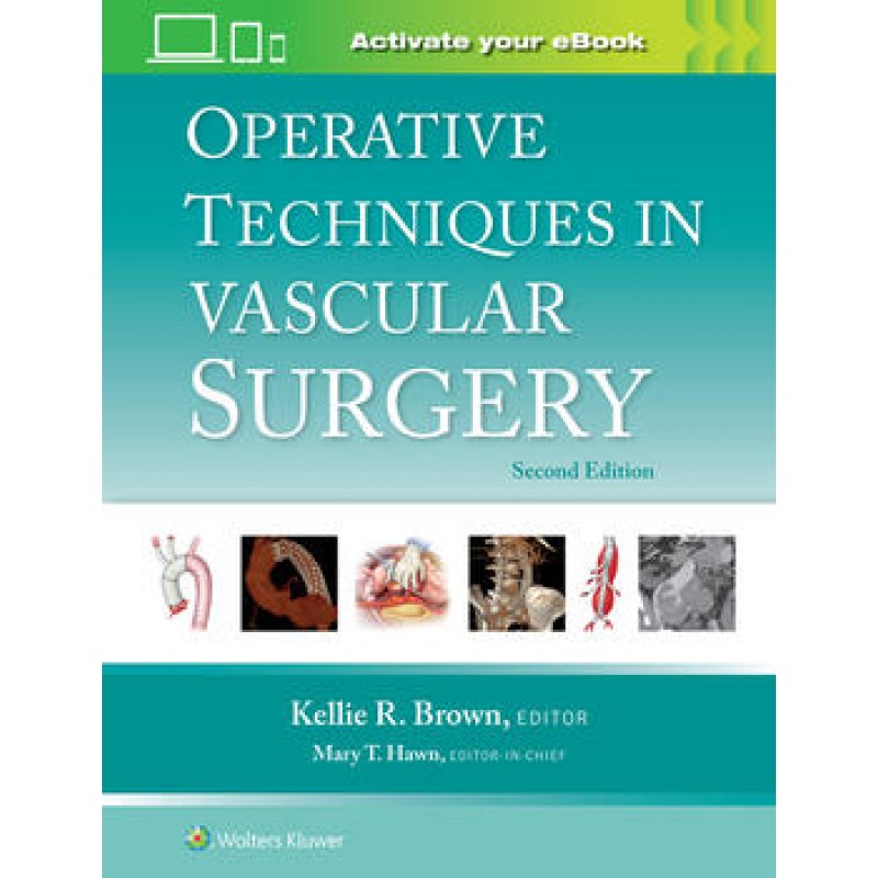 Operative Techniques in Vascular Surgery 2E 