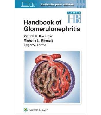 Handbook of Glomerulonephritis