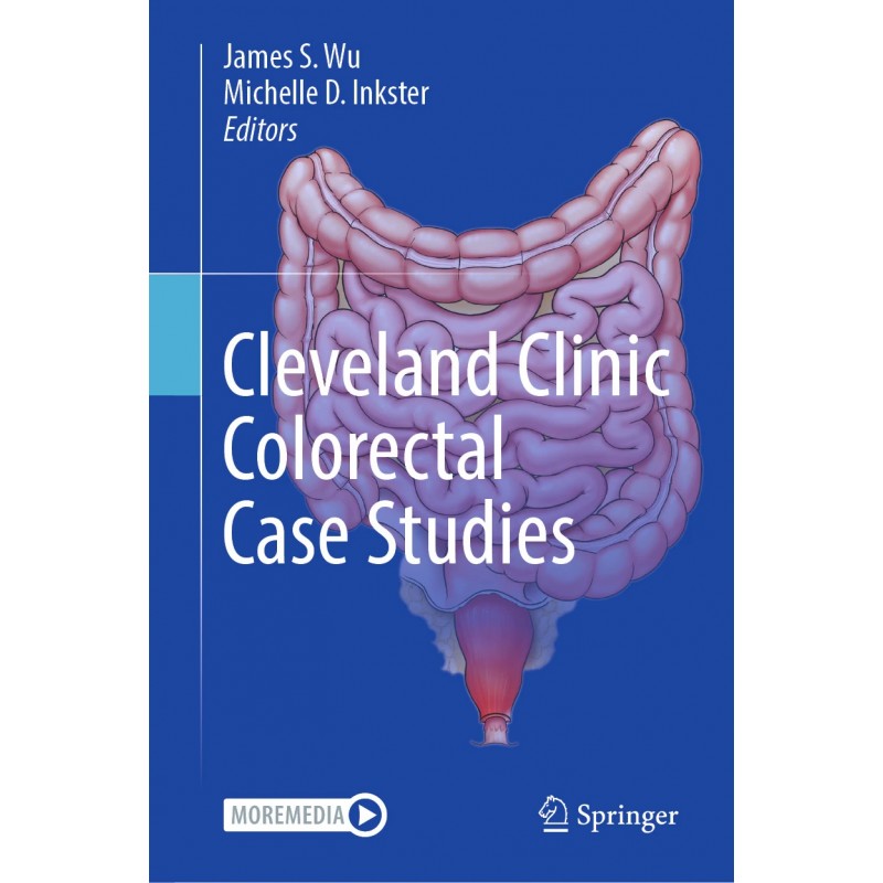 Cleveland Clinic Colorectal Case Studies
