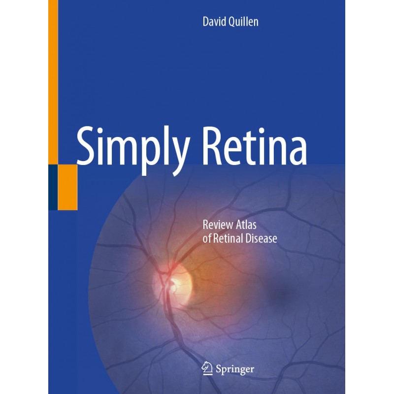 Simply Retina. Review Atlas of Retinal Disease