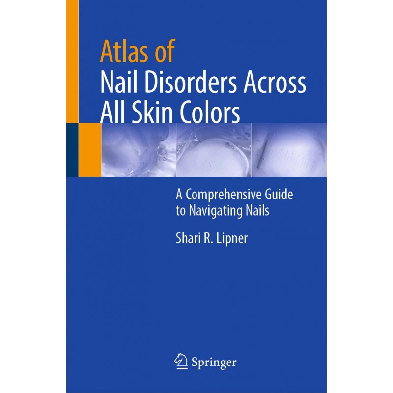Atlas of Nail Disorders Across All Skin Colors. A Comprehensive Guide to Navigating Nails