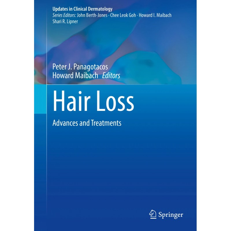 Hair Loss. Advances and Treatments