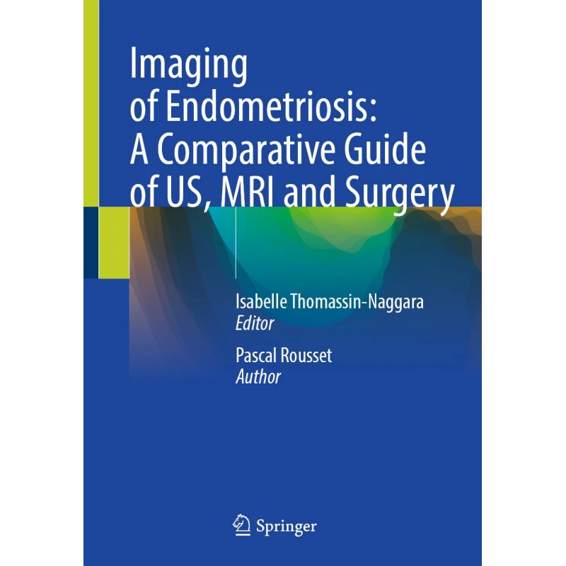  Imaging of Endometriosis: A Comparative Guide of US, MRI and Surgery