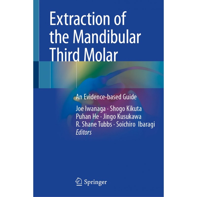 Extraction of the Mandibular Third Molar  An Evidence-based Guide