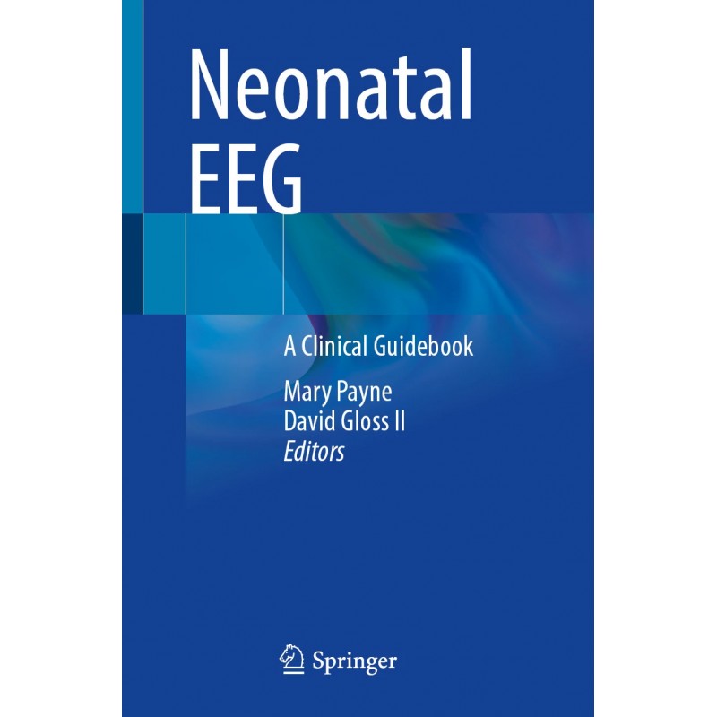 Neonatal EEG. A Clinical Guidebook