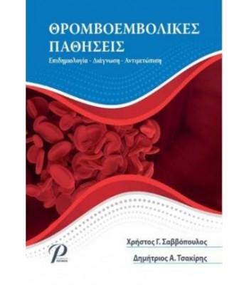 Θρομβοεμβολικές Παθήσεις: Επιδημιολογία, Διάγνωση, Αντιμετώπιση