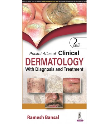 Pocket Atlas of Clinical Dermatology with Diagnosis and Treatment