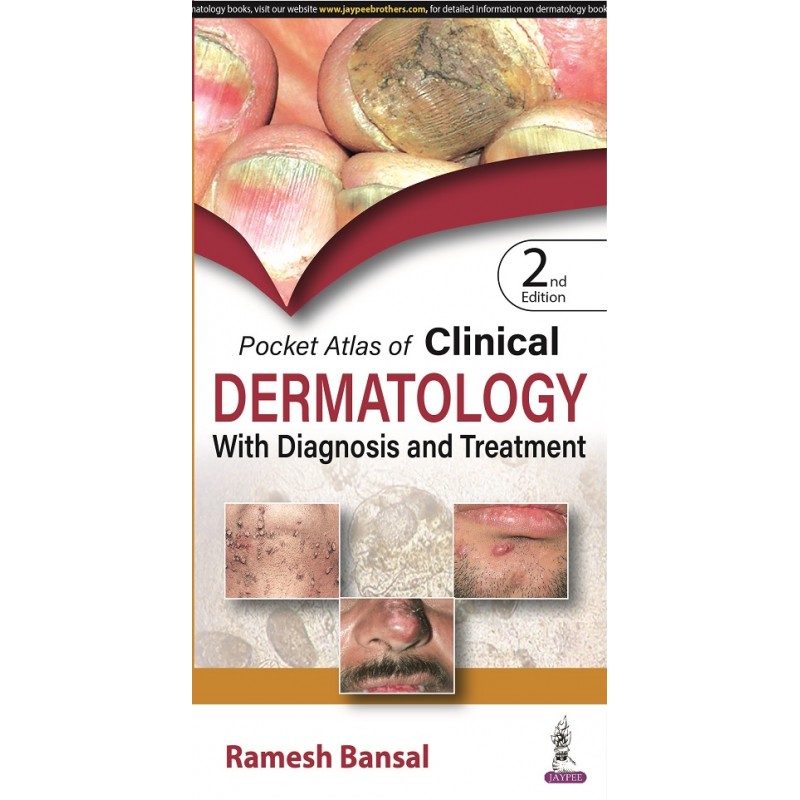 Pocket Atlas of Clinical Dermatology with Diagnosis and Treatment