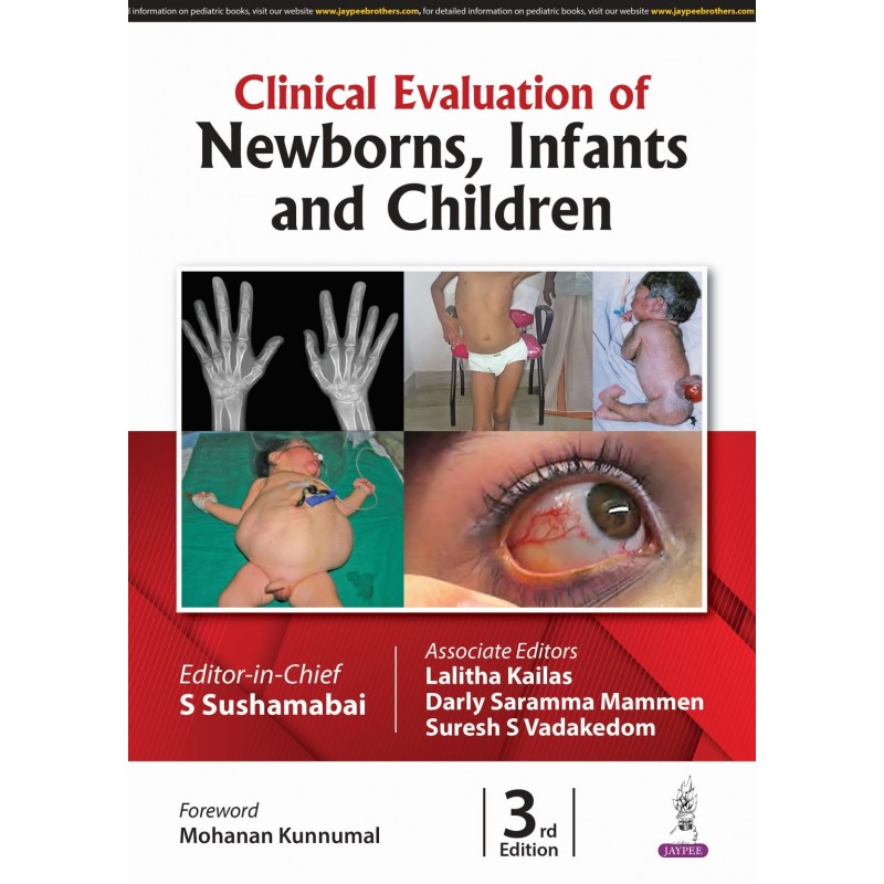  Clinical Evaluation of Newborns, Infants and Children