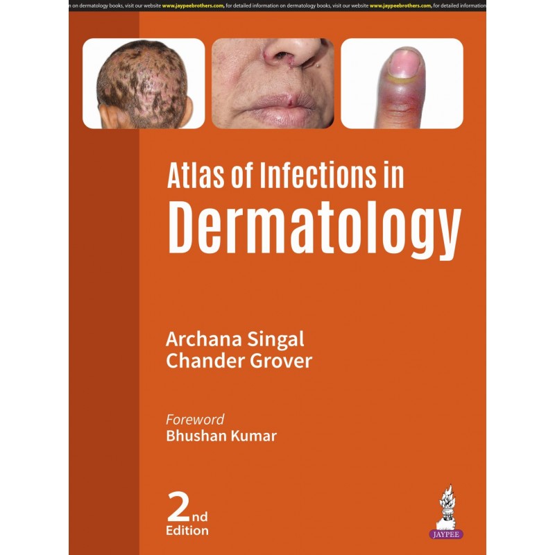 Atlas of Infections in Dermatology