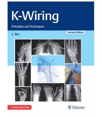 K-Wiring: Principles and Techniques, 2nd Edition