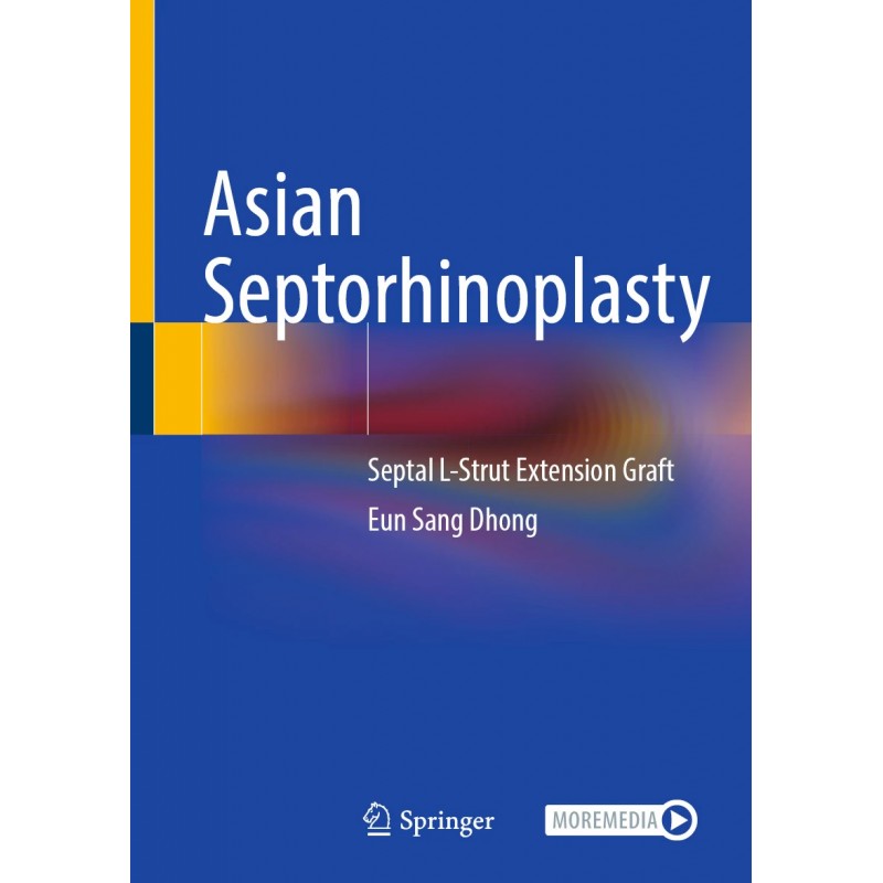Asian Septorhinoplasty. Septal L-Strut Extension Graft