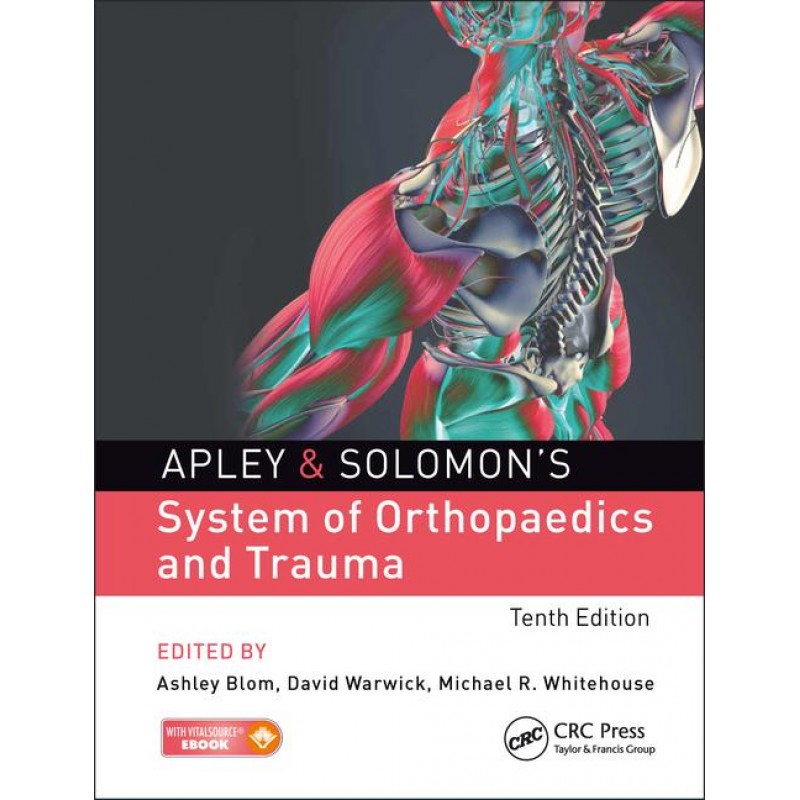 Apley and Solomon's System of Orthopaedics and Trauma