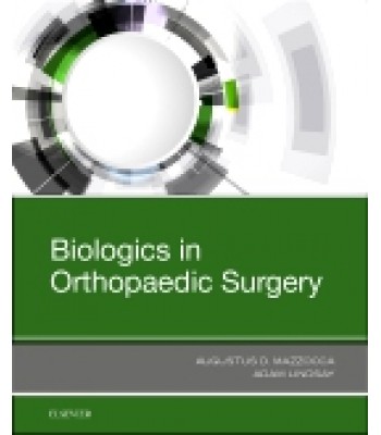 Biologics in Orthopaedic Surgery
