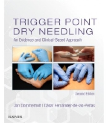 Trigger Point Dry Needling, 2nd Edition