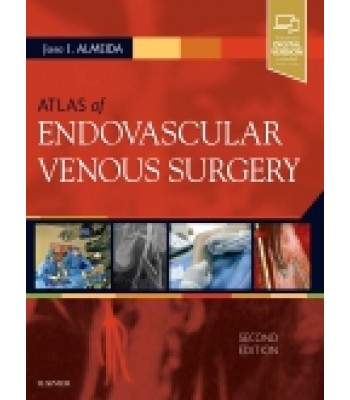 Atlas of Endovascular Venous Surgery, 2nd Edition