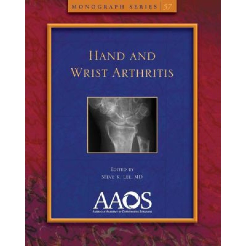 Hand and Wrist Arthritis