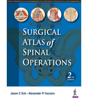 Surgical Atlas of Spinal Operations