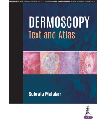 Dermoscopy: Text and Atlas