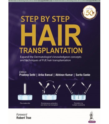 Step by Step Hair Transplantation