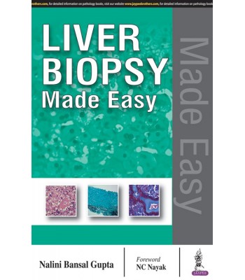 Liver Biopsy Made Easy