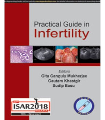 Practical Guide to Infertility
