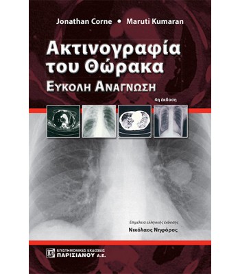 Ακτινογραφία του Θώρακα : Εύκολη Ανάγνωση (4η έκδοση)