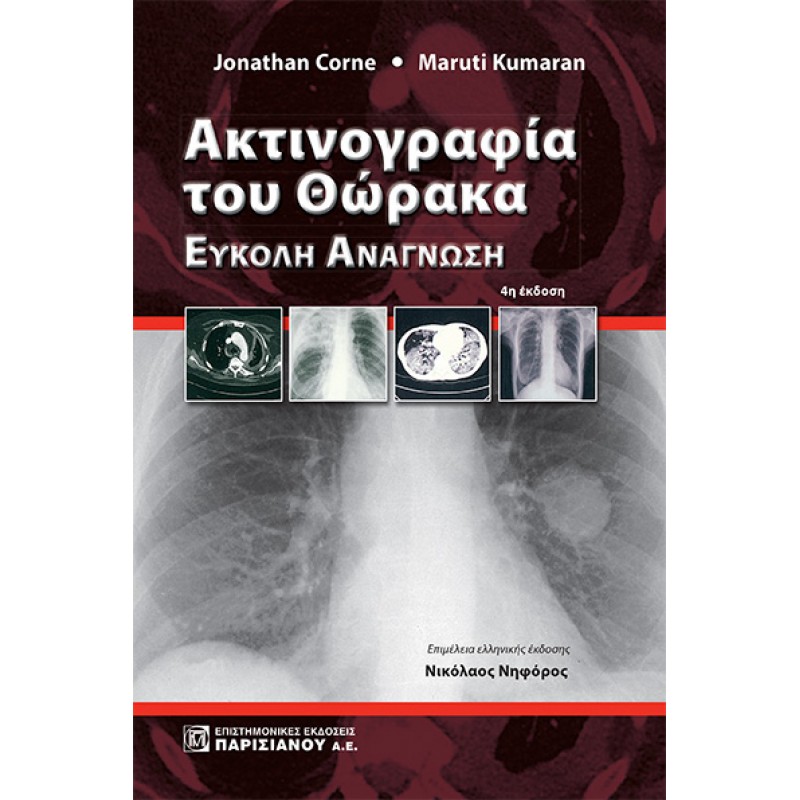 Ακτινογραφία του Θώρακα : Εύκολη Ανάγνωση (4η έκδοση)