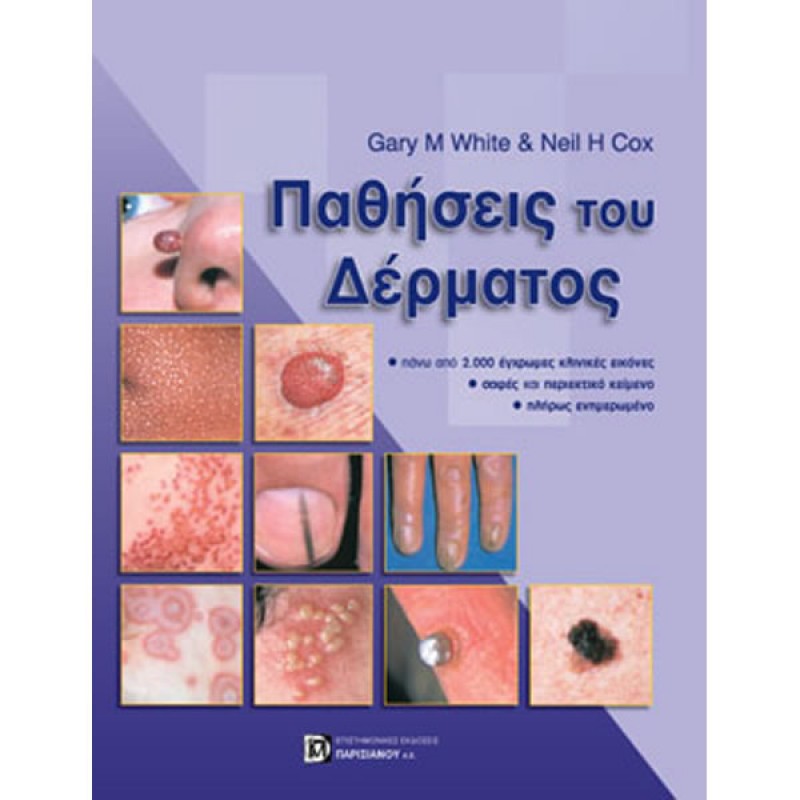 Παθήσεις του Δέρματος
