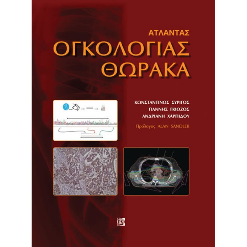 Άτλαντας Ογκολογίας Θώρακα