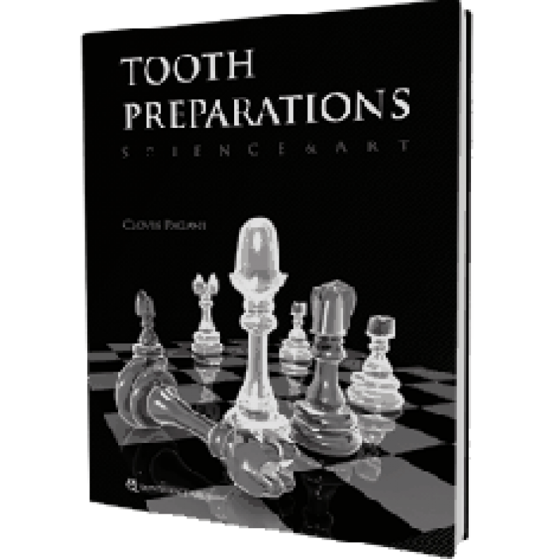 Tooth Preperations Science and Art
