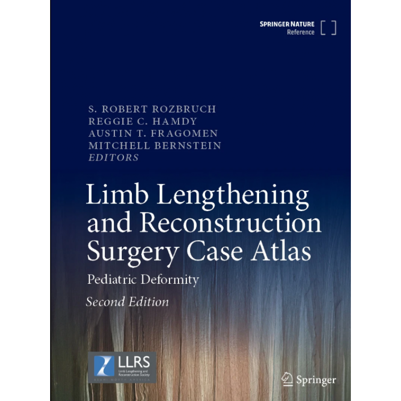 Limb Lengthening and Reconstruction Surgery Case Atlas. Pediatric Deformity