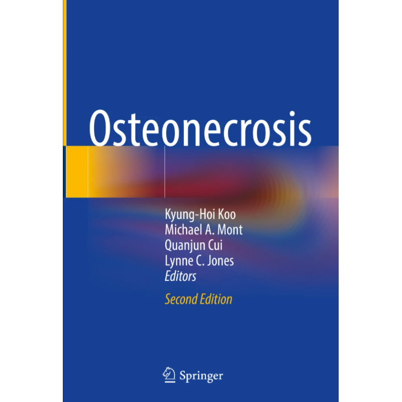 Osteonecrosis