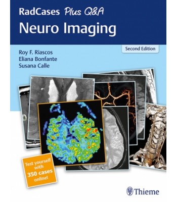 RadCases Plus Q-A Neuro Imaging