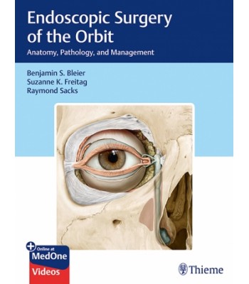 Endoscopic Surgery of the Orbit