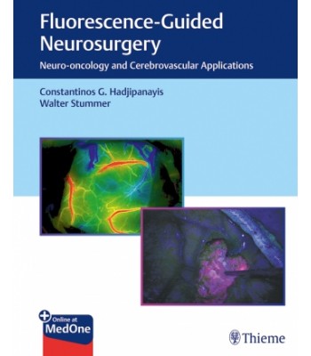 Fluorescence-Guided Neurosurgery