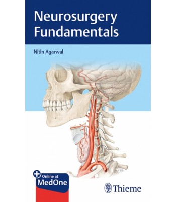 Neurosurgery Fundamentals