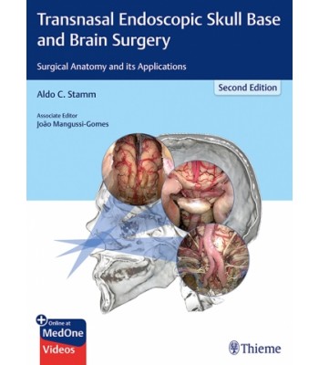 Transnasal Endoscopic Skull Base and Brain Surgery