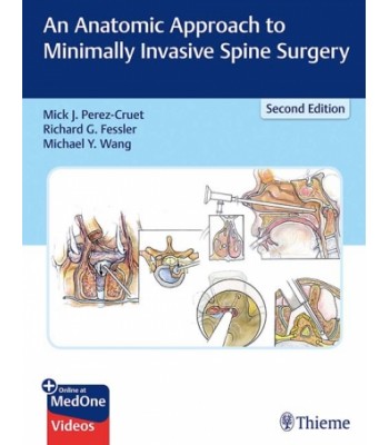 An Anatomic Approach to Minimally Invasive Spine Surgery