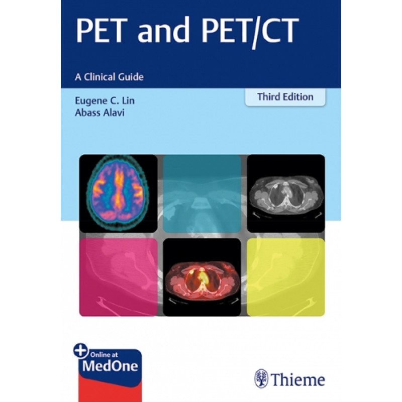 PET and PET/CT