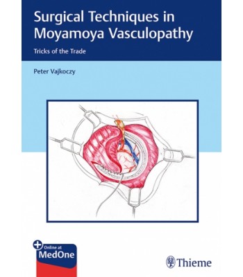 Surgical Techniques in Moyamoya Vasculopathy